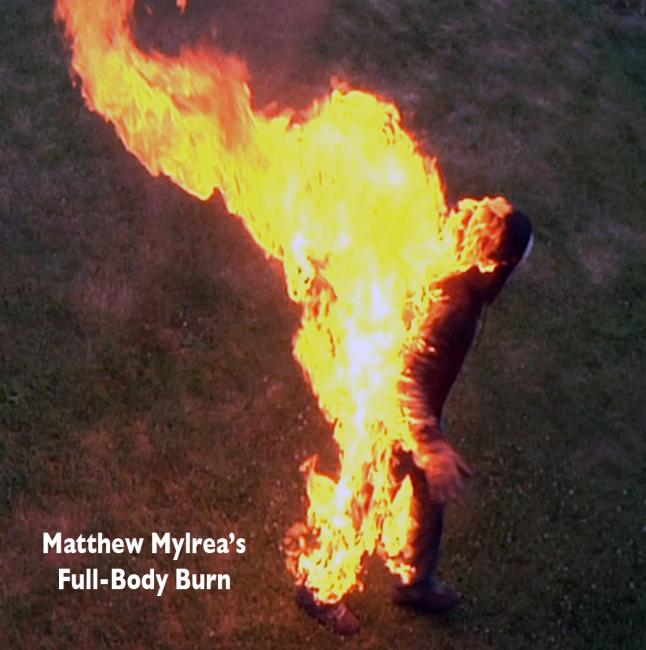 Matt Mylrea - Full-body Burn
